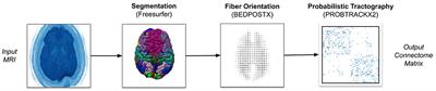 The Case for Optimized Edge-Centric Tractography at Scale